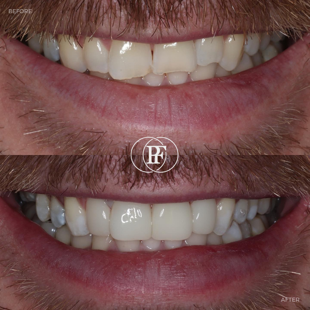 The Hollies Dental Practice PAIN FREE DENTIST DUNOON The Hollies Dental Practice PAIN FREE DENTIST DUNOON