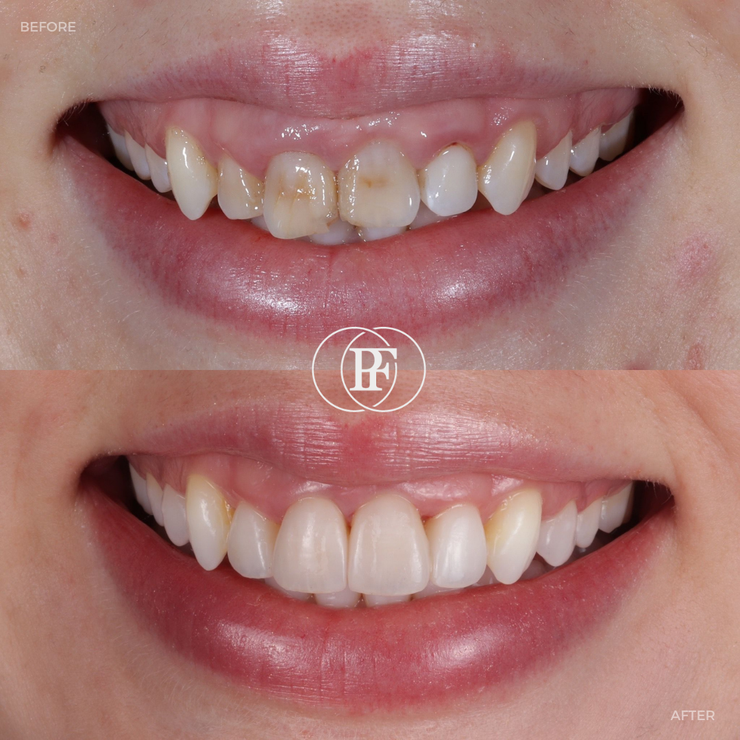 The Hollies Dental Practice PAIN FREE DENTIST DUNOON The Hollies Dental Practice PAIN FREE DENTIST DUNOON