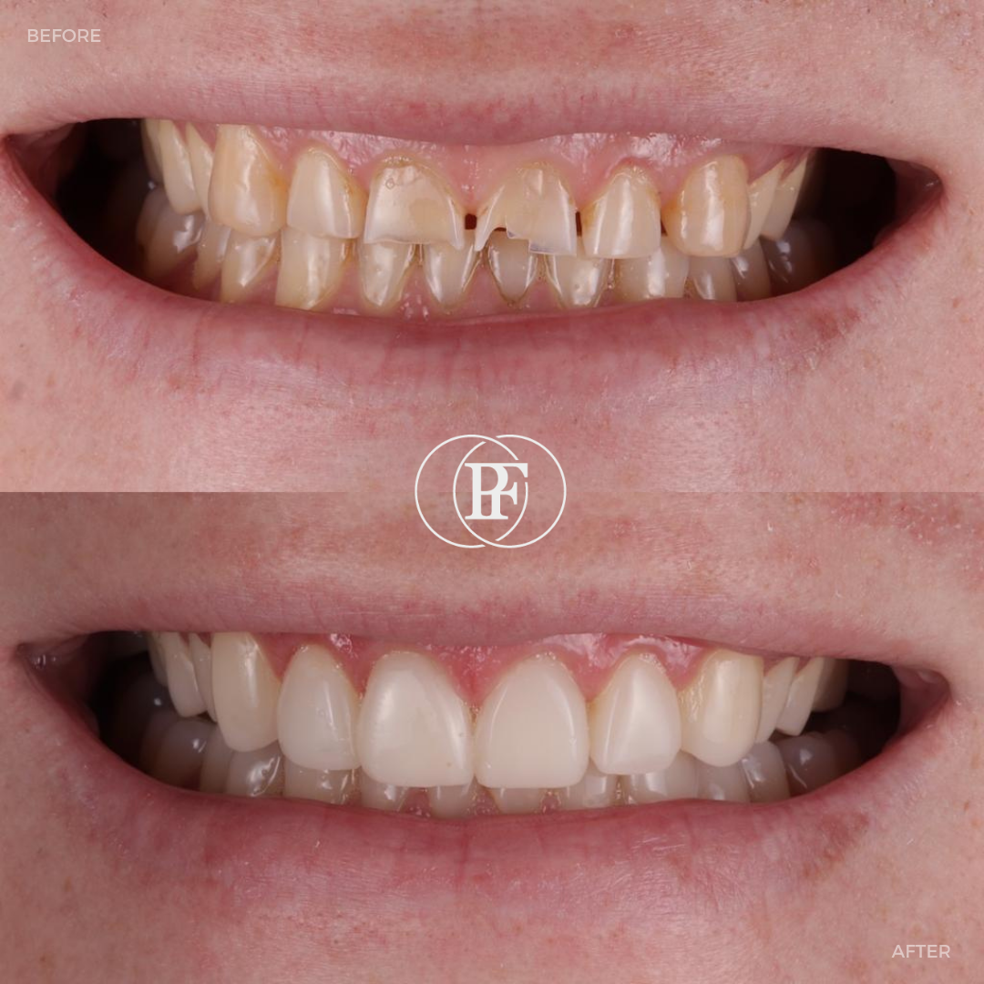 The Hollies Dental Practice PAIN FREE DENTIST DUNOON The Hollies Dental Practice PAIN FREE DENTIST DUNOON
