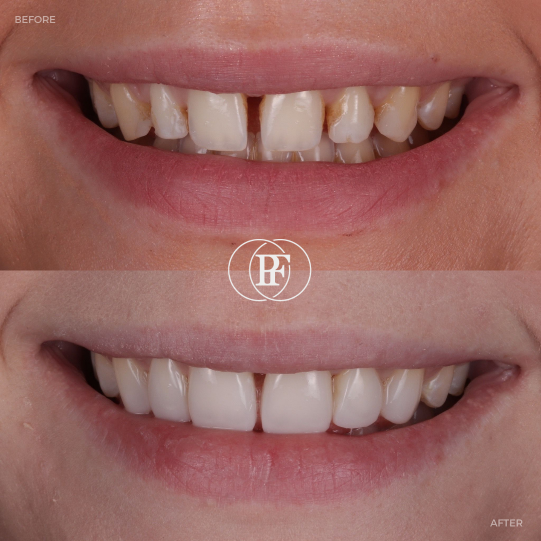 The Hollies Dental Practice PAIN FREE DENTIST DUNOON The Hollies Dental Practice PAIN FREE DENTIST DUNOON