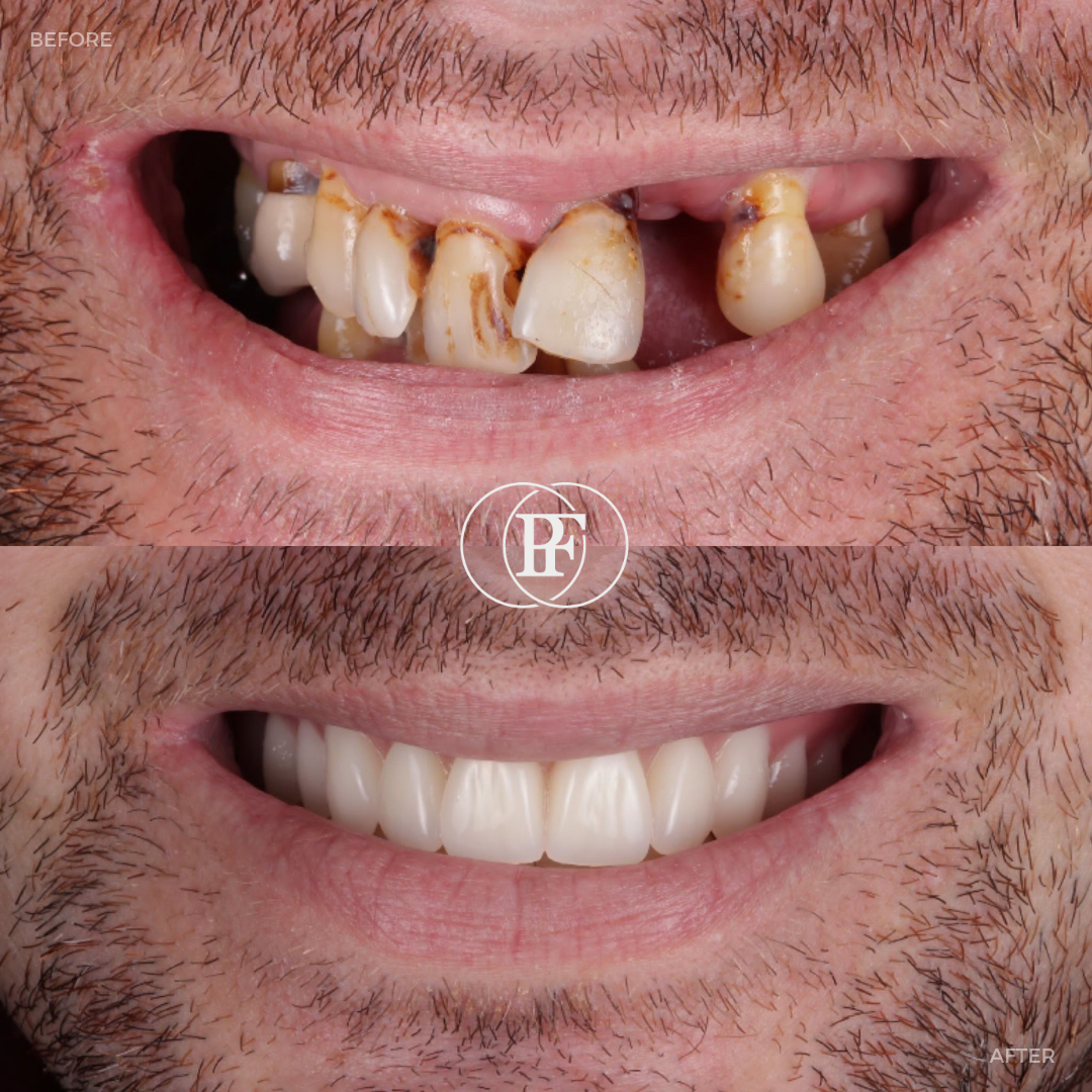 The Hollies Dental Practice PAIN FREE DENTIST DUNOON The Hollies Dental Practice PAIN FREE DENTIST DUNOON