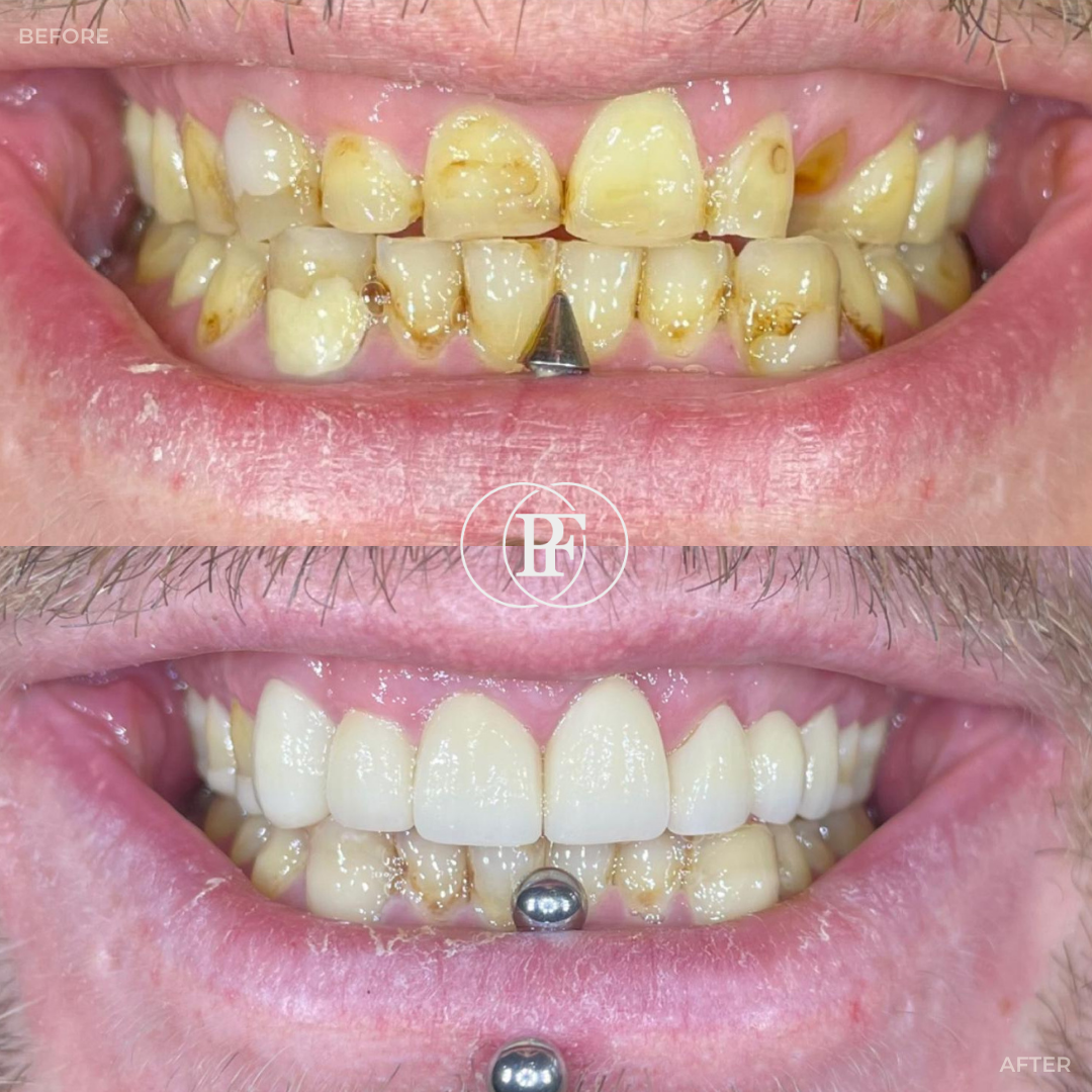 The Hollies Dental Practice PAIN FREE DENTIST DUNOON The Hollies Dental Practice PAIN FREE DENTIST DUNOON