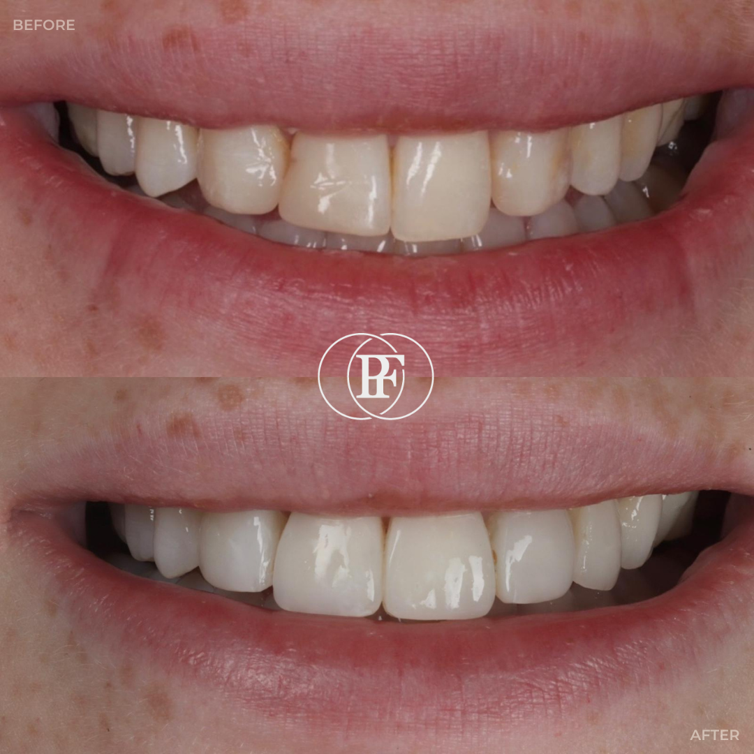 The Hollies Dental Practice PAIN FREE DENTIST DUNOON The Hollies Dental Practice PAIN FREE DENTIST DUNOON