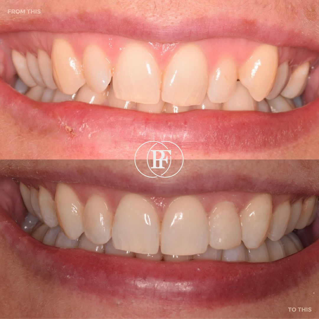 The Hollies Dental Practice PAIN FREE DENTIST DUNOON The Hollies Dental Practice PAIN FREE DENTIST DUNOON