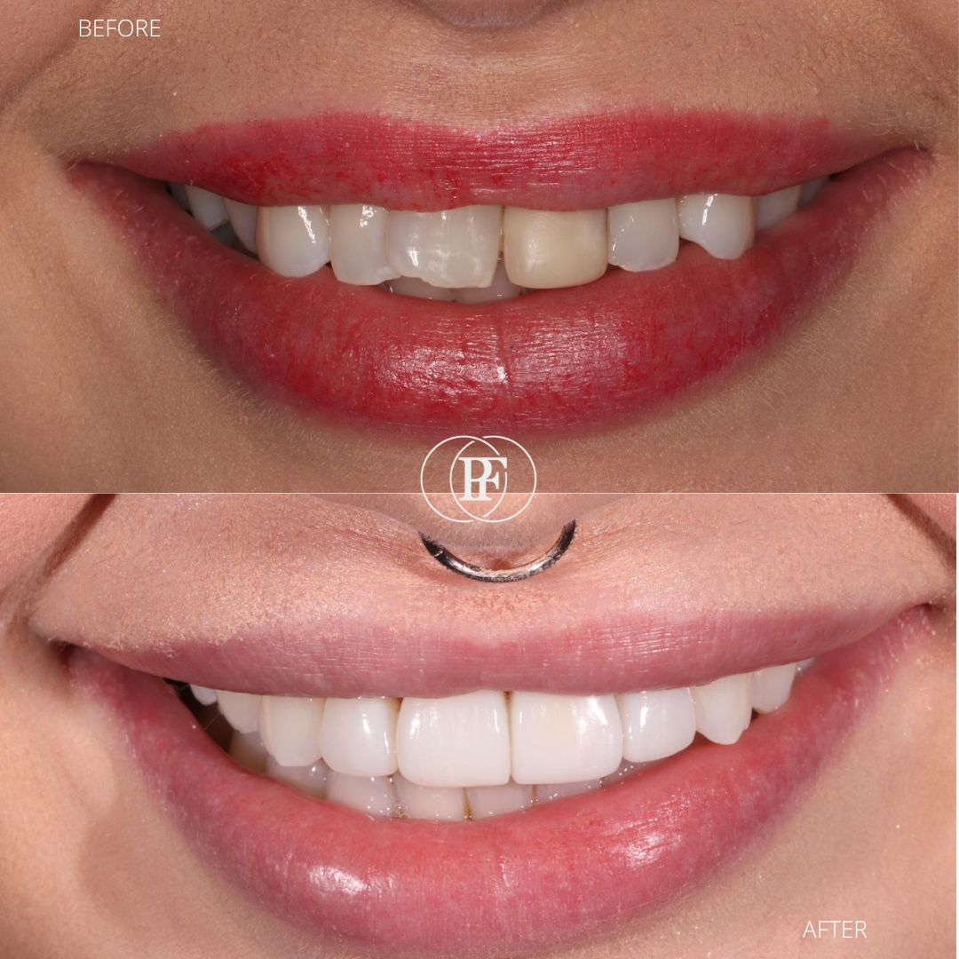 The Hollies Dental Practice PAIN FREE DENTIST DUNOON The Hollies Dental Practice PAIN FREE DENTIST DUNOON